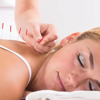 st Petersburg acupuncture