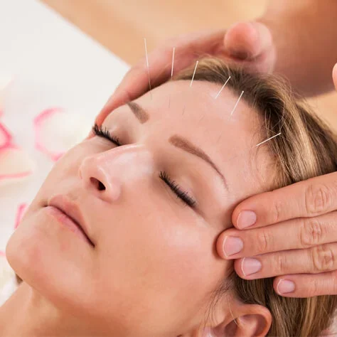 st Petersburg acupuncture